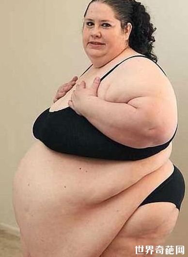 世界最胖的女人 重544公斤