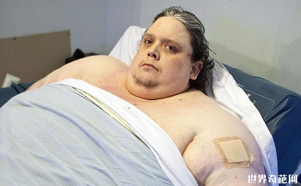 历史上世界最胖的人 基思·马丁