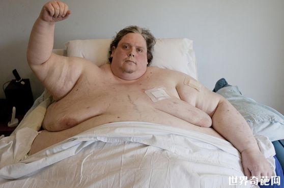 历史上世界最胖的人-基思·马丁死亡