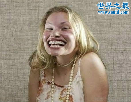 世界上最丑陋的女人，世界上20个最丑的人(怕吐