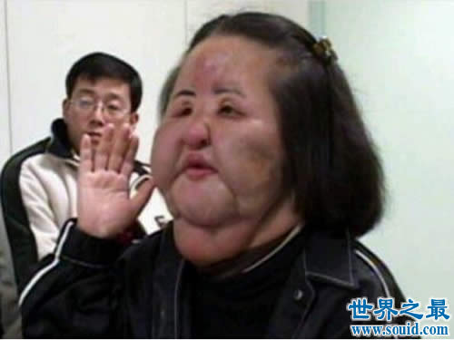 世界上最丑陋的女人，世界上20个最丑的人(怕吐