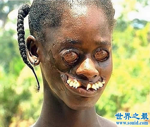 世界上最丑陋的女人，世界上20个最丑的人(怕吐
