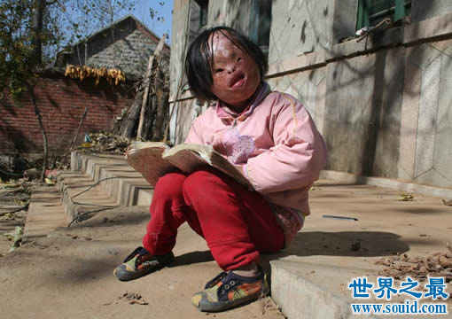 世界上最丑陋的女人，世界上20个最丑的人(怕吐