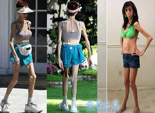 世界上最丑陋的女人，世界上20个最丑的人(怕吐