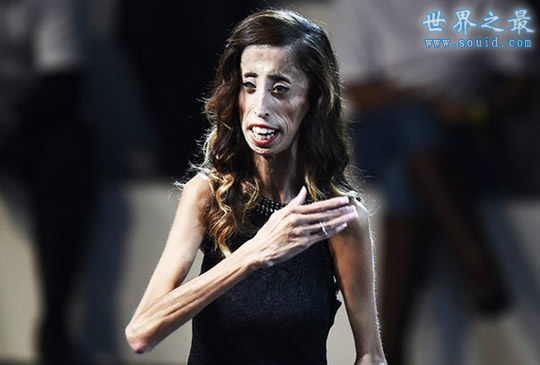 世界上最丑陋的女人，世界上20个最丑的人(怕吐