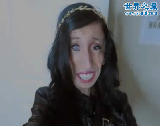 世界上最丑陋的女人，世界上20个最丑的人(怕吐