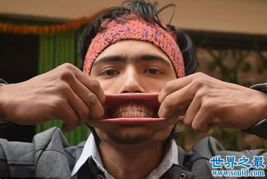 最新世界第一大嘴，尼泊尔男子嘴巴插进138支铅